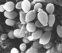 thm_wd_SEM 6500x wt 25C budding yeasts .jpg (9112 bytes)