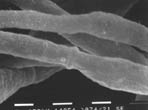thm_wd_SEM hf1 28C hyphae.jpg (6339 bytes)