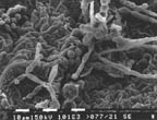 thm_wd_SEM hf1 isotropic cells hyphae.jpg (10298 bytes)