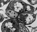 thm_wd_SEM muriform.jpg (15301 bytes)