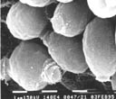 thm_wd_SEM wt 25C yeast bud scar.jpg (8702 bytes)