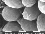 thm_wd_SEM wt 25C yeast bud scar2.jpg (8534 bytes)