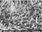 thm_wd_SEM wt 37C budding.jpg (11867 bytes)
