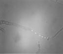thm_wd_hyphae nuclei mythramycin stain.jpg (3224 bytes)