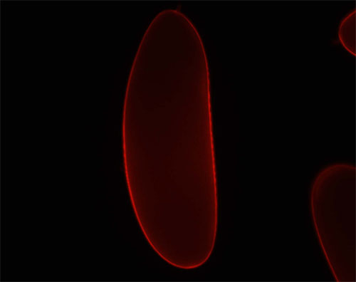 David Stein - VML-RFP localizes to the Drosophila Eggshell